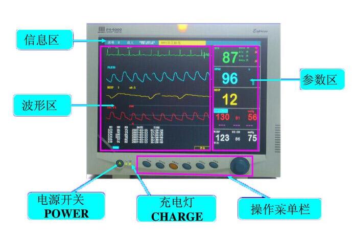 它能及时反映患者在心率,呼吸,血压,脉搏,心电波形中存在的问题